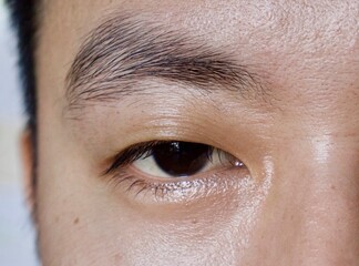 Asian, Chinese young man with single eyelid or monolid. A monolid means that there is no visible...