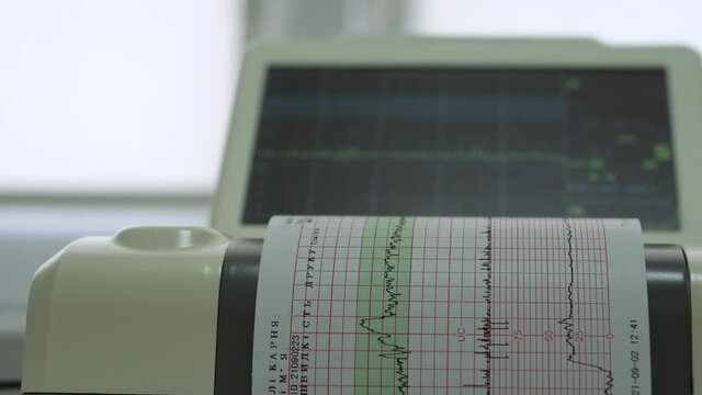 Electronic Cardiotocography Machine Monitoring Fetal Heart Contractions Of Uterus. Printing Cardiogram Report Coming Out Electrocardiogram In Labor Ward During Pregnancy. Medical Diagnostic Equipment