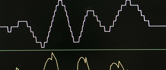 Measurement of the received radio signals are often different on an oscilloscope.