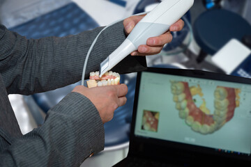 Denture scanning process. Checking teeth with an intraoral scanner. Dental intraoral scanner in hands in a suit. Monitor with video display from device in background. Electronic dental  scanner - obrazy, fototapety, plakaty