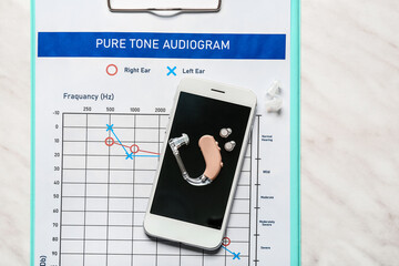 Mobile phone with hearing aid and audiogram on white background
