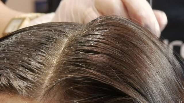 Dyeing female hair in a dark color in a hairdressing salon. hairdresser hand applied coloring pigment in the skin of the head salon client beauty close up view