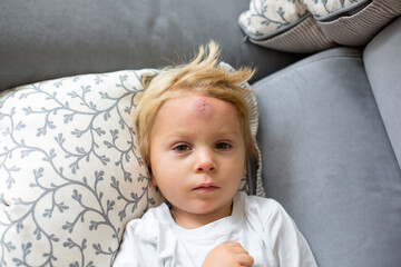 Toddler boy, lying on the couch with big bump on the forehead after falling from a swing