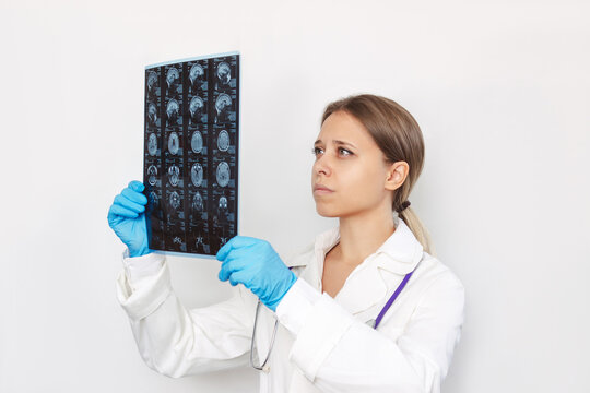 A young blonde female doctor examining MRI scan of head and brain of patient isolated on a white background. MRI scan of brain and arteries by computer tomography in the doctor's hands