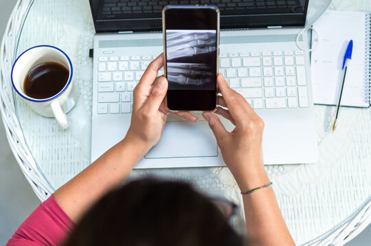 Woman watching her x-ray on mobile phone at home while drinking coffee, online doctor concept.