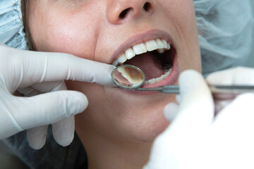 Boca abierta es revisada por la mano con guantes de un odontólogo sosteniendo un espejo
