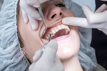 Mujer joven abre su boca y es revisada por el odontólogo con un espejo dental	