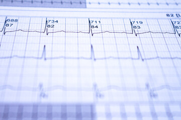 Electrocardiogram recorded on graph paper. Study of the human heart.