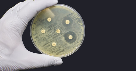 Antimicrobial susceptibility resistance test by diffusion on black background