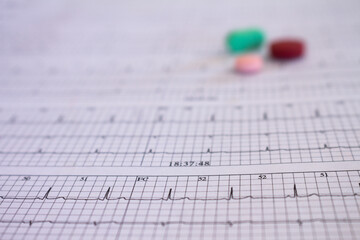 Electrocardiogram of a cardiac patient. Heartbeat written on paper. Selective focus.