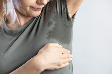 Young woman with hyperhidrosis sweating. Young woman with sweat stain on her clothes..