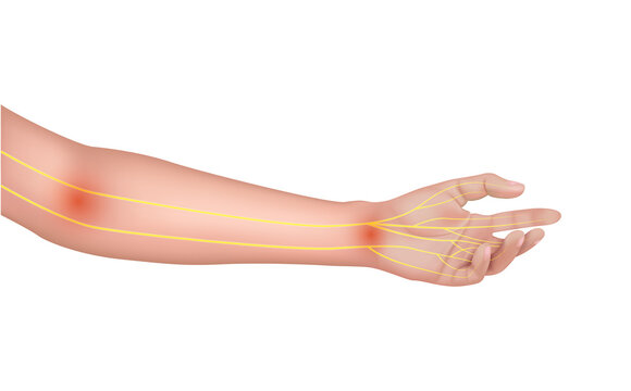 Nerve of the arm about human anatomy yellow. On a white background. Medical and scientific concepts
