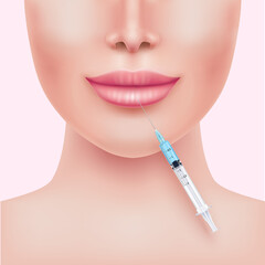 Lip enhancement filler in cosmetology. Hyaluronic acid gel. Botox injection lips. Medical and beauty concept. Realistic 3D vector EPS10 illustration.