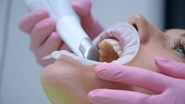 Dentist Scaning Patient's Teeth With 3d Scanner In Dental Clinic. Healthcare And Stomatology Concept. Close Up