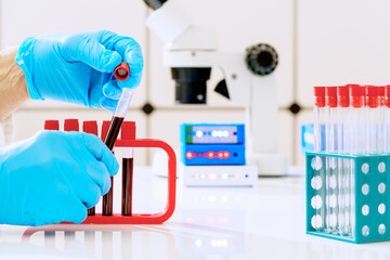 Blood test for hormones and microelements in a biochemical laboratory. Test tubes with blood in the...
