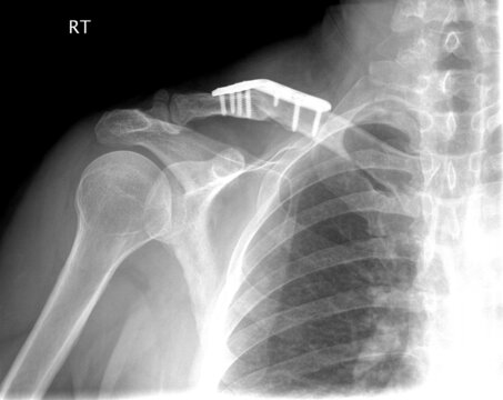 X rays from the hospital