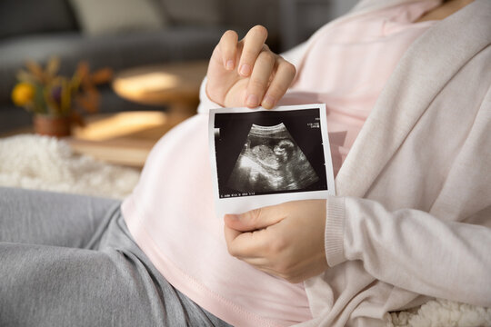 First photo of beloved baby. Close up of happy young woman expecting child hold sonogram image of future newborn close to pregnant tummy. Prenatal diagnostics pregnancy reproductive healthcare concept