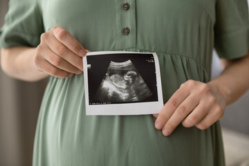 Prenatal ultrasound screening. Cropped close up shot of young pregnant female holding sonogram picture of unborn baby inside her big belly. Happy expectant mom showing fetus usi scan image to camera