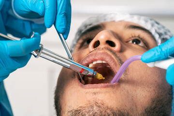 dentist's hands injecting anaesthesia into a patient's mouth in a dental clinic - obrazy, fototapety, plakaty