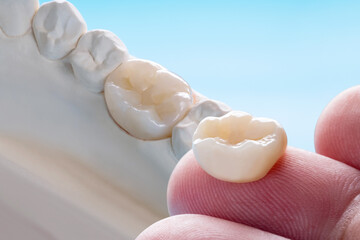 Closeup / Prosthodontics or Prosthetic / Single teeth crown and bridge equipment model express fix...