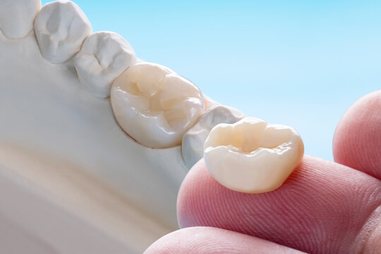 Closeup / Prosthodontics or Prosthetic / Single teeth crown and bridge equipment model express fix restoration.