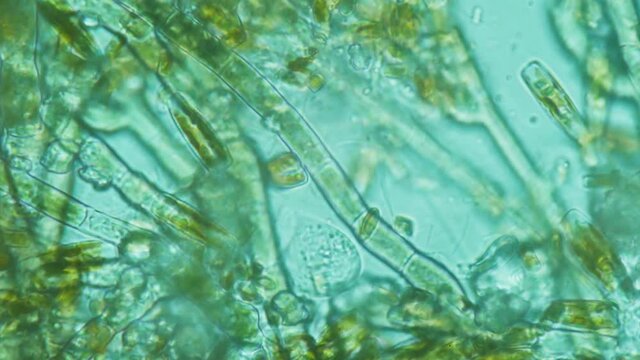 The natural habitat of unicellular organisms, bacteria, algae. A drop of fresh water under a microscope