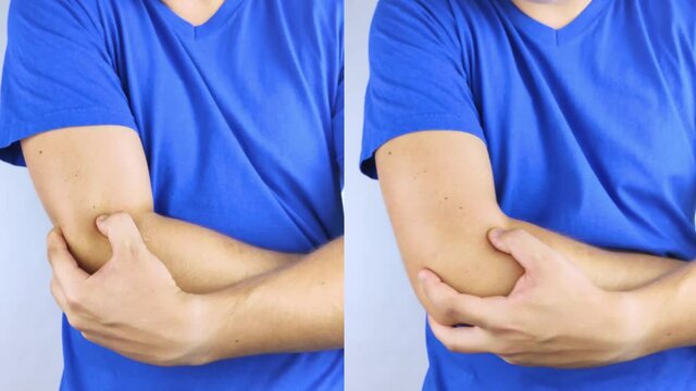 Before and after. On left man is holding onto his injured elbow. On right the doctors have already cured the patient. Elbow tendon rupture, muscle rupture, cartilage injury, bone fracture or fissure