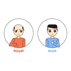 Male cartoon character vector illustration with hair loss problem. Happy man with thumb up after alopecia treatment. Health problem concept.