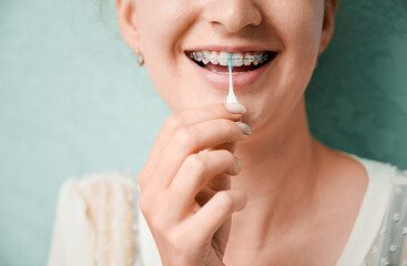 Close up of woman using elastic cleaning toothpick while brushing teeth with orthodontic brackets....