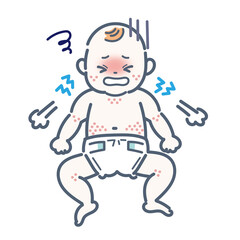 アナフィラキシーショックを起こした赤ちゃん