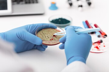 Scientist Works with Petri Dishes with Bacteria, Tissue and Blood Samples. Concept of...