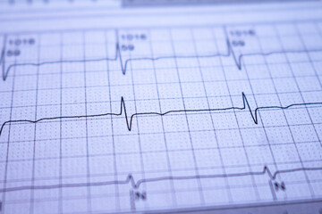 Heartbeat recorded on paper. Cardiovascular study.