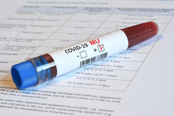 Blood tube for test detection of virus Covid-19 Mu Variant with positive result on papers document.