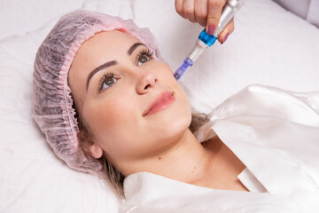 Beautiful woman receiving microneedling rejuvenation treatment. Mesotherapy..