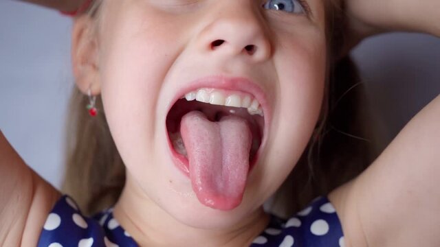 girl opens her mouth wide and pulls out long tongue. child shows his teeth soft palate and mouth to dentist. mouth is wide open, tongue is stuck out as far as possible, with clear view of tongue