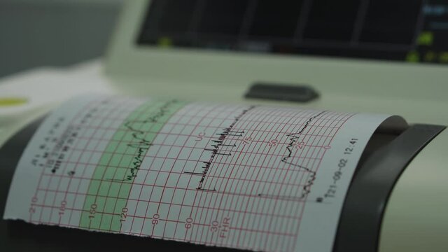 Electronic Cardiotocography Machine Monitoring Fetal Heart Contractions Of Uterus. Printing Cardiogram Report Coming Out Electrocardiogram In Labor Ward During Pregnancy. Medical Diagnostic Equipment