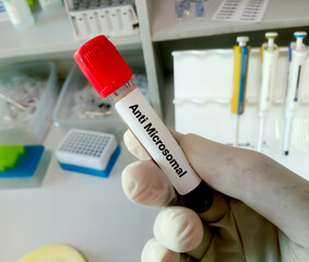 Blood sample tube for anti microsomal or anti TPO test, diagnosis for thyroid disease