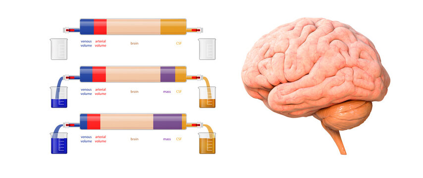 Brain, mass, arterial volume, venous volume, CSF - cerebrospinal fluid acronym, medical concept background, 3d render