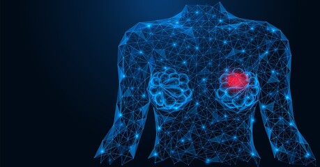 Inflammation of the breast in women. Female breasts with signs of the disease. A low-poly construction of interconnected lines and points. Blue background. - obrazy, fototapety, plakaty