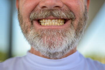 Close up on the teeth and chin of a senior bearded man