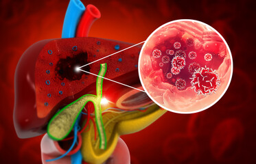 Liver disease. Liver infection. Viral infection. 3d illustration