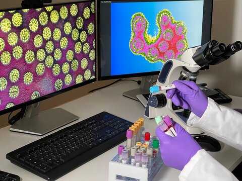 Laboratory assistant doing research with papillomavirus images on a computer.