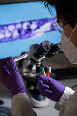 Blood test for syphilis caused by the bacterium treponema pallidum or pale treponema. This infection is sexually transmitted.