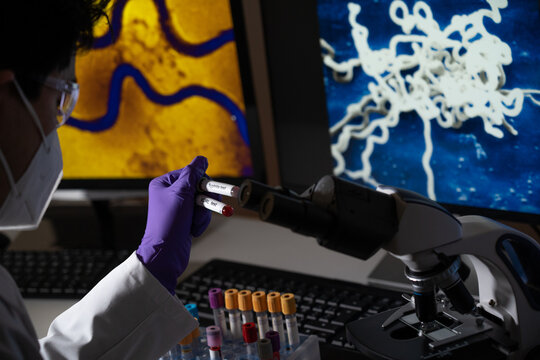 Blood test for syphilis caused by the bacterium treponema pallidum or pale treponema. This infection is sexually transmitted.