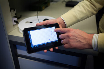 Monitoring of human metabolism with an implant equipped with 5 bio-sensors capable of detecting molecules such as glucose or cholesterol.
