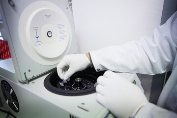 Laboratory analyzes and results to test the effectiveness of an aids vaccine. - obrazy, fototapety, plakaty