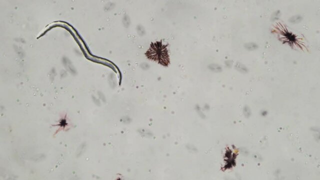 Biology. Researching the Cells of the microorganism. Looking at the Worm of the microorganism. Studying the Life Environment of a microorganism. Microbiological Laboratory. Modern Science. Microbe.