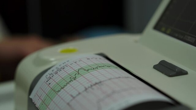 Electronic Cardiotocography Machine Monitoring Fetal Heart Contractions Of Uterus. Printing Cardiogram Report Coming Out Electrocardiogram In Labor Ward During Pregnancy. Medical Diagnostic Equipment