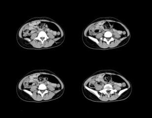 Abdomen ct scan and MRI professional images