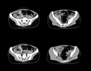 Abdomen ct scan and MRI professional images